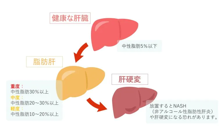 脂肪肝